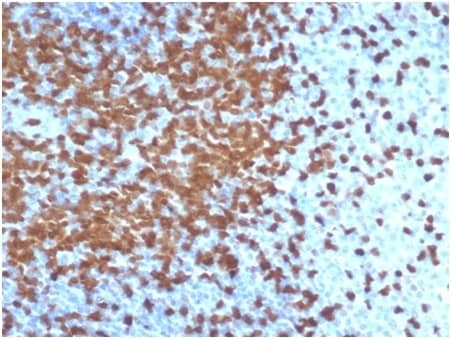 Formalin-fixed, paraffin-embedded human tonsil stained with ZAP70 Antibody (ZAP70/6492R).