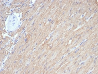 Formalin-fixed, paraffin-embedded human smooth muscle stained with Caldesmon/CALD1 Antibody (rCALD1/7266). HIER: Tris/EDTA, pH9.0, 45min. 2 °: HRP-polymer, 30min. DAB, 5min.