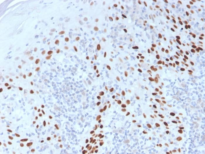 Formalin-fixed, paraffin-embedded Cervix stained with p40/deltaNp63 Antibody.