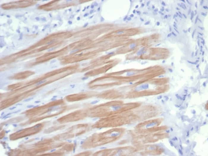 Formalin-fixed, paraffin-embedded human heart muscle stained with Alpha Actinin 2 Antibody (rACTN2/7361). HIER: Tris/EDTA, pH9.0, 45min. 2�C: HRP-polymer, 30min. DAB, 5min.