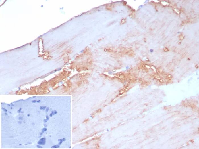 Formalin-fixed, paraffin-embedded human skeletal muscle stained with Alpha Actinin 2 Antibody (rACTN2/8177). Inset: PBS instead of primary antibody; secondary only negative control.