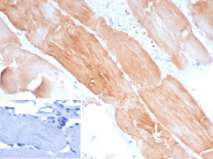 Formalin-fixed, paraffin-embedded human skeletal muscle stained with Alpha Actinin 2 Antibody (ACTN2/8184R). Inset: PBS instead of primary antibody; secondary only negative control.