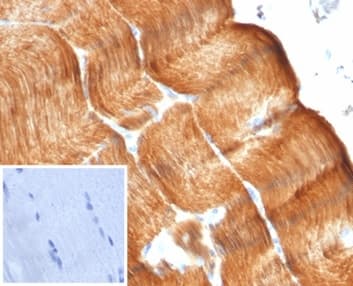 Formalin-fixed, paraffin-embedded human skeletal muscle stained with Alpha Actinin 2 Antibody (ACTN2/7041R). Inset: PBS instead of primary antibody; secondary only negative control.