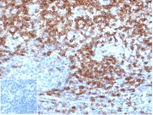 IHC analysis of formalin-fixed, paraffin-embedded human tonsil.  Strong surface staining using CD5 Antibody (C5/4561R) at 2ug/ml in PBS for 30min RT. Inset: PBS instead of primary antibody; secondary only negative control.