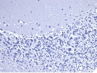 IHC analysis of formalin-fixed, paraffin-embedded human brain. Negative tissue control using CD5 Antibody (C5/6463R) at 2ug/ml in PBS for 30min RT. HIER: Tris/EDTA, pH9.0, 45min. 2�C: HRP-polymer, 30min. DAB, 5min.