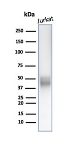 Western blot analysis of Jurkat cell lysate using CD5 Antibody (C5/6438R).
