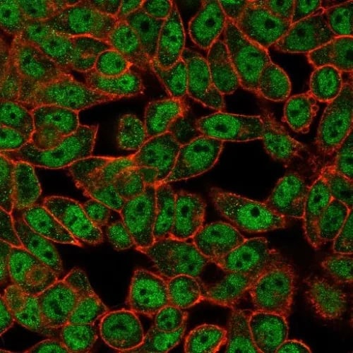 Immunocytochemistry/ Immunofluorescence GCM2 Antibody (PCRP-GCM2-1B3)