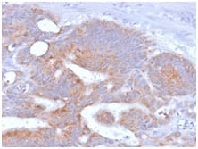 Formalin-fixed, paraffin-embedded human Colon stained with B7-2/CD86 Antibody (rC86/1146).