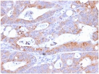 Formalin-fixed, paraffin-embedded human Colon stained with B7-2/CD86 Antibody (C86/2160R).
