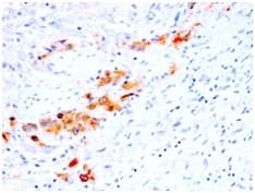Formalin-fixed, paraffin-embedded human Bladder stained with CD44, variant 4 Antibody (rCD44v4/1219).