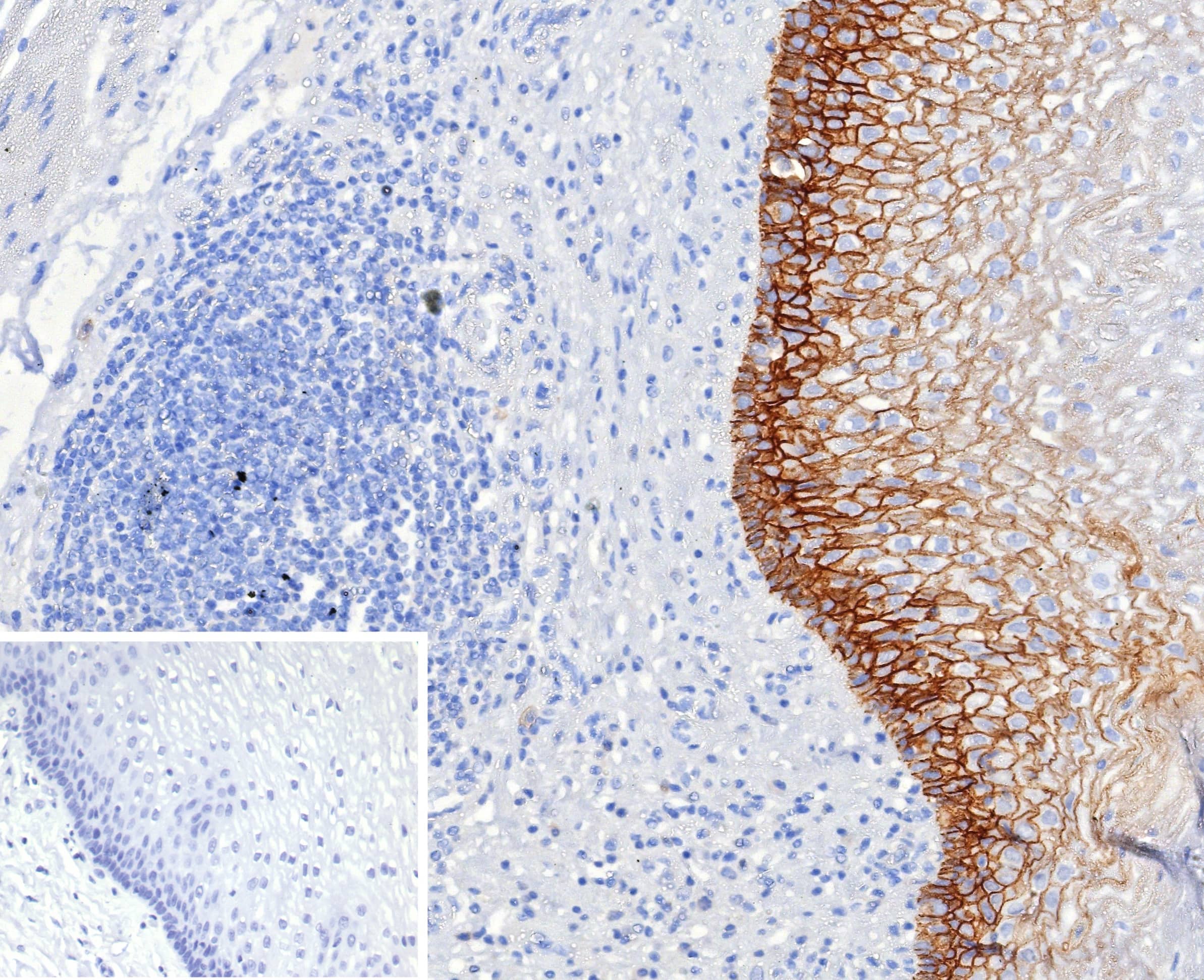 Formalin-fixed, paraffin-embedded human esophagus stained with CD44, variant 6 Antibody (CD44V6/2496). Inset: PBS instead of primary antibody; secondary only negative control. 