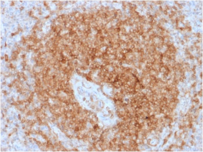 Formalin-fixed, paraffin-embedded human Spleen stained with CD79A Antibody (rIGA/764).