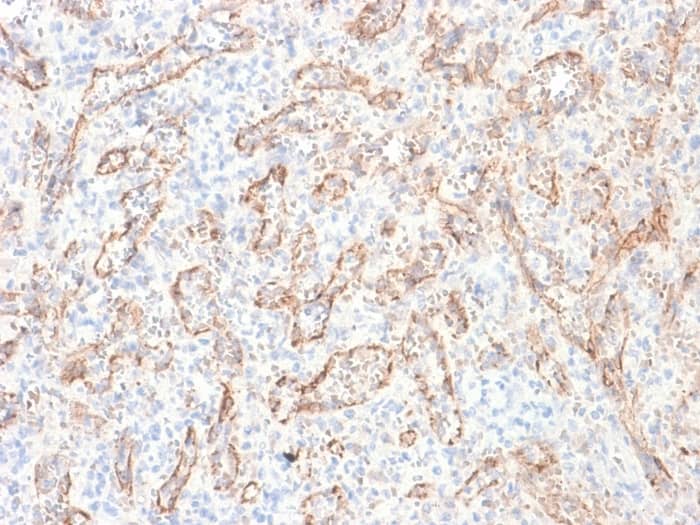 Formalin-fixed, paraffin-embedded human Spleen stained with TL1A/TNFSF15 Antibody (rVEGI/1283).
