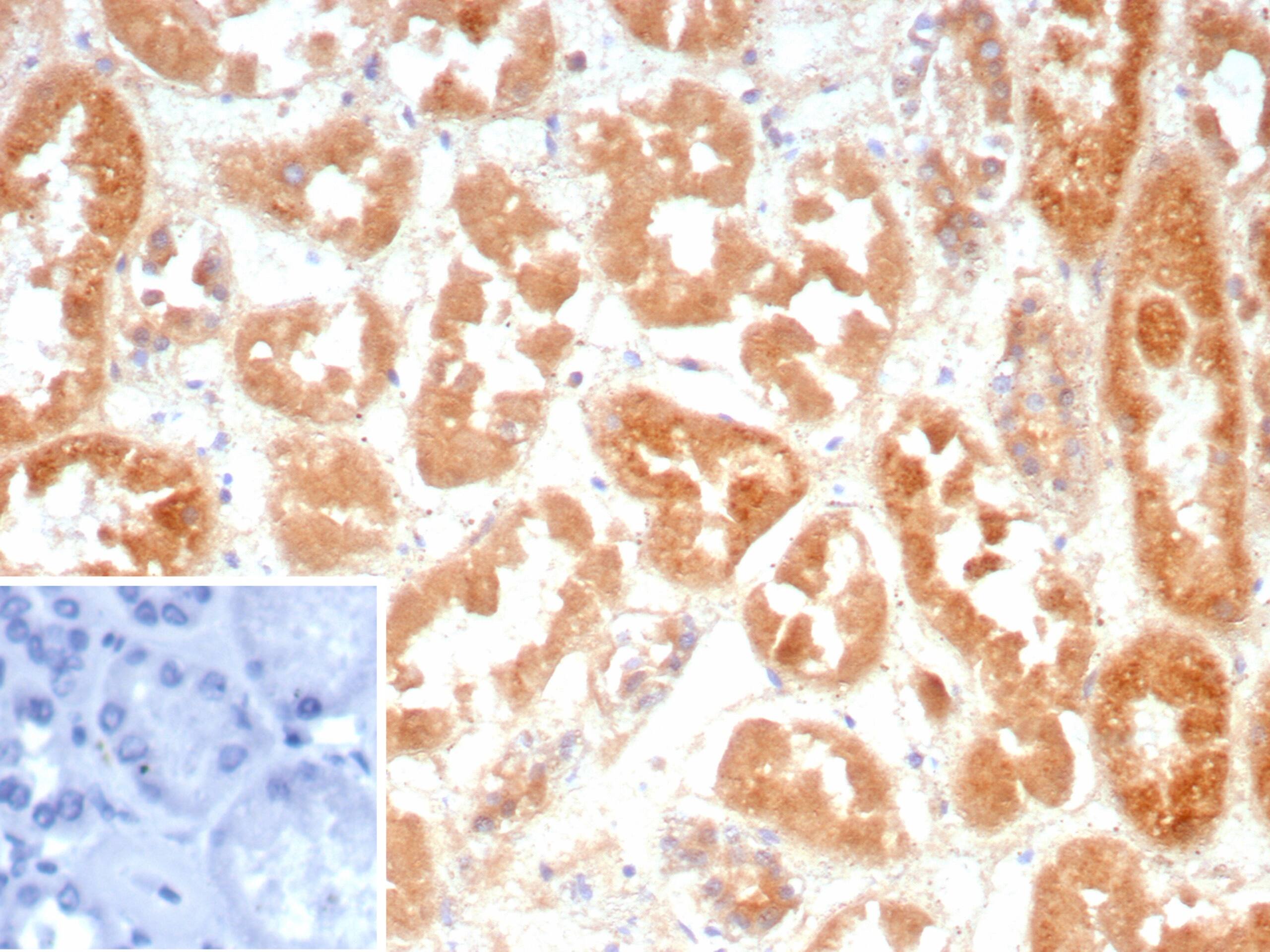 Formalin-fixed, paraffin-embedded human kidney stained with Cadherin-6/KCAD Antibody (CDH6/9300R). Inset: PBS instead of primary antibody; secondary only negative control.