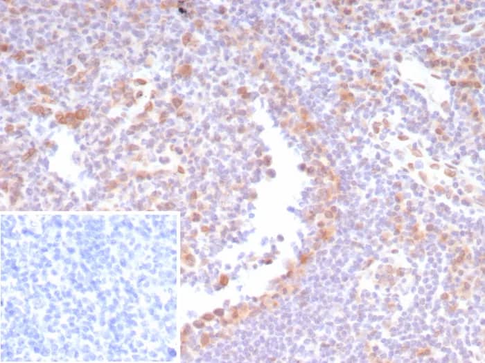 Formalin-fixed, paraffin-embedded human tonsil stained with CDK4 Antibody (CDK4/8210R). Inset: PBS instead of primary antibody; secondary only negative control.