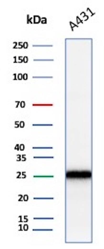 Western blot analysis of A431 lysate using p27/Kip1 Antibody (KIP1/1355R).