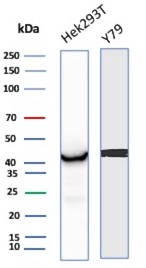 Western Blot Analysis of HEK293T, Y79 cell lysate using Creatine Kinase BB Antibody (CKBB/8843R).
