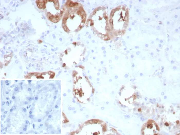 Formalin-fixed, paraffin-embedded human kidney stained with Creatine Kinase BB Antibody (rCKBB/8839). Inset: PBS instead of primary antibody; secondary only negative control.