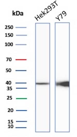 Western Blot Analysis of HEK293T & Y79 cell lysate using Creatine Kinase BB Antibody (rCKBB/8839).