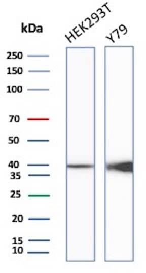 Western Blot Analysis of HEK293T & Y79 cell lysate using Creatine Kinase BB Antibody (rCKBB/8839).