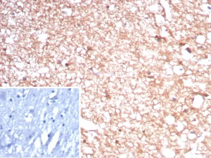 Formalin-fixed, paraffin-embedded human brain stained with Creatine Kinase BB Antibody (rCKBB/8841). Inset: PBS instead of primary antibody; secondary only negative control.