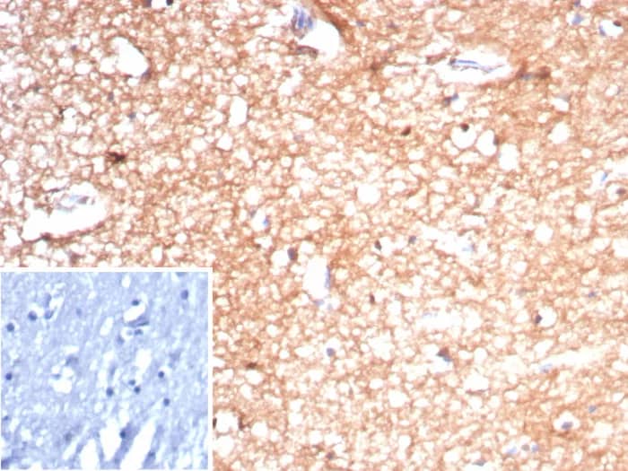Formalin-fixed, paraffin-embedded human brain stained with Creatine Kinase BB Antibody (rCKBB/8842). Inset: PBS instead of primary antibody; secondary only negative control.