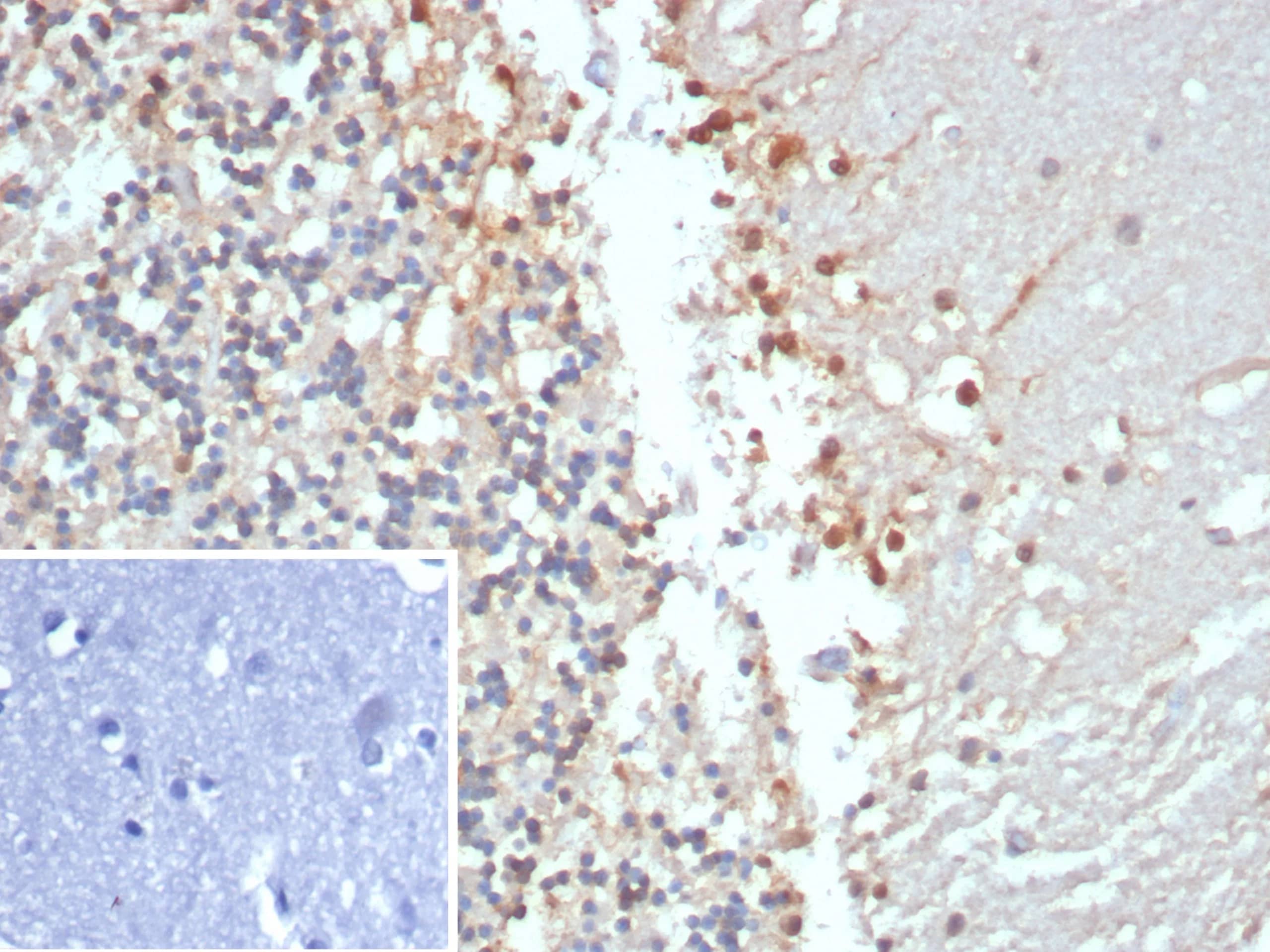 Immunohistochemistry-Paraffin Creatine Kinase BB Antibody (CKBB/8306R)