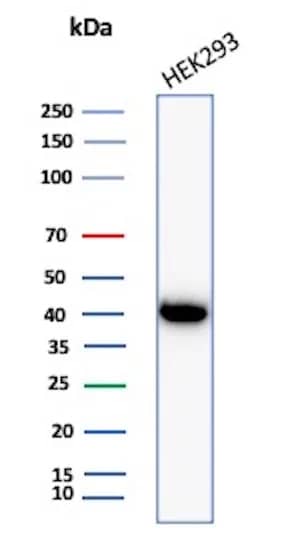 Western Blot Creatine Kinase BB Antibody (CKBB/8306R)