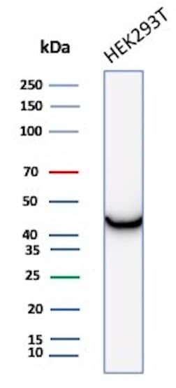 Western Blot Creatine Kinase BB Antibody (CKBB/8306R)