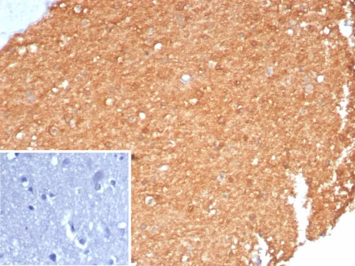 Formalin-fixed, paraffin-embedded human brain stained with Creatine Kinase BB Antibody (CKBB/8310R). Inset: PBS instead of primary antibody; secondary only negative control.