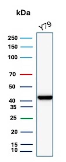Western blot analysis of Y79 cell lysate using Creatine Kinase BB Antibody (CKBB/8310R).