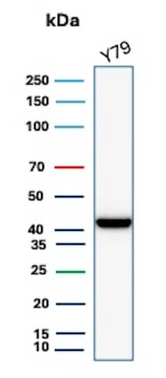 Western blot analysis of Y79 cell lysate using Creatine Kinase BB Antibody (CKBB/8608R).
