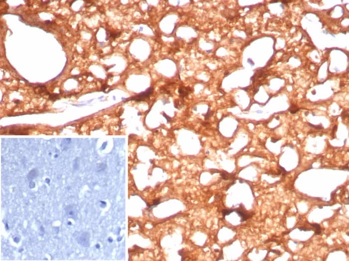 Formalin-fixed, paraffin-embedded human brain stained with Creatine Kinase BB Antibody (CKBB/8843R). Inset: PBS instead of primary antibody; secondary only negative control.