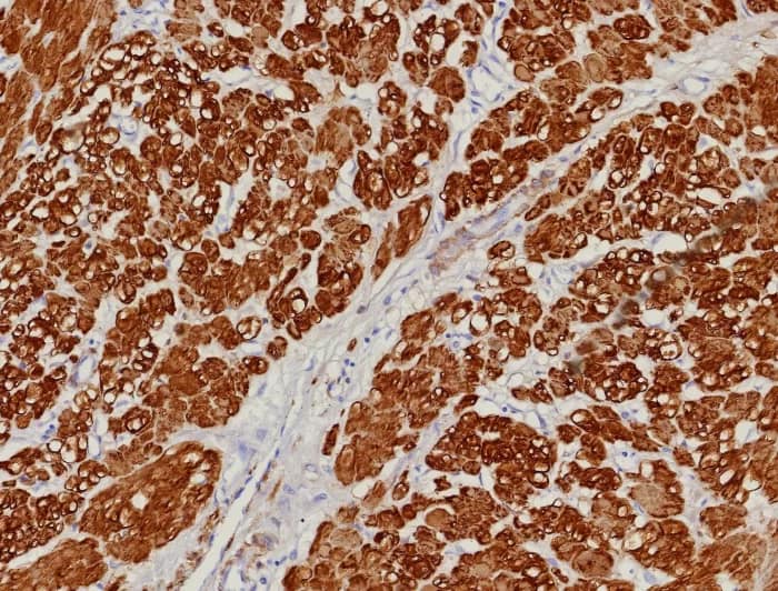 Formalin-fixed, paraffin-embedded human uterus stained with Calponin 1 Antibody (rCNN1/9164). HIER: Tris/EDTA, pH9.0, 45min. 2�C: HRP-polymer, 30min. DAB, 5min.
