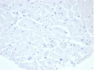 IHC analysis of formalin-fixed, paraffin-embedded human heart. Negative tissue control using Alkaline Phosphatase/ALPP/ALPI Antibody (rALP/870)at 2ug/ml in PBS for 30min RT. HIER: Tris/EDTA, pH9.0, 45min. 2 °: HRP-polymer, 30min. DAB, 5min.