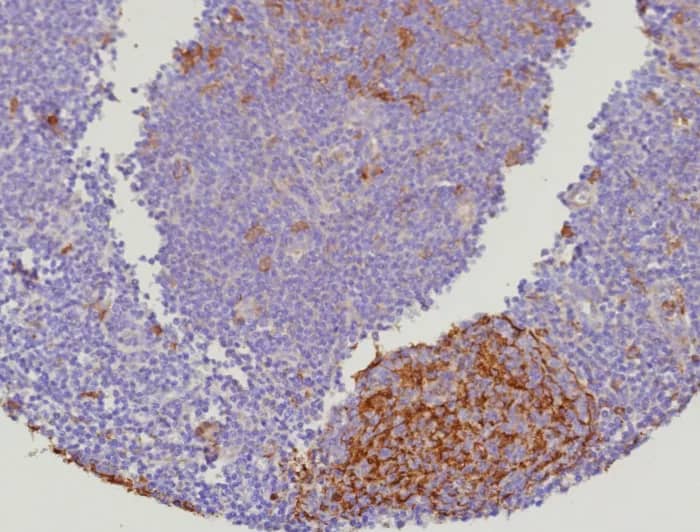 Formalin-fixed, paraffin-embedded human lymph node stained with Cystatin A Antibody (CSTA/9087R). HIER: Tris/EDTA, pH9.0, 45min. 2�C: HRP-polymer, 30min. DAB, 5min.