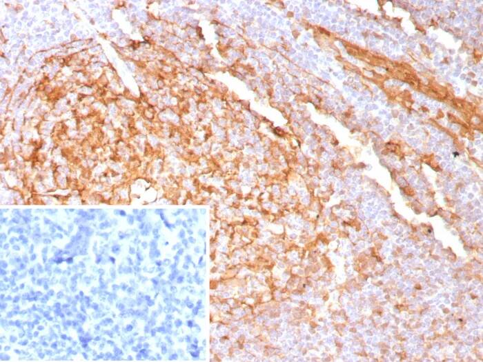 Formalin-fixed, paraffin-embedded human tonsil stained with Cystatin A Antibody (CSTA/9087R). Inset: PBS instead of primary antibody; secondary only negative control.