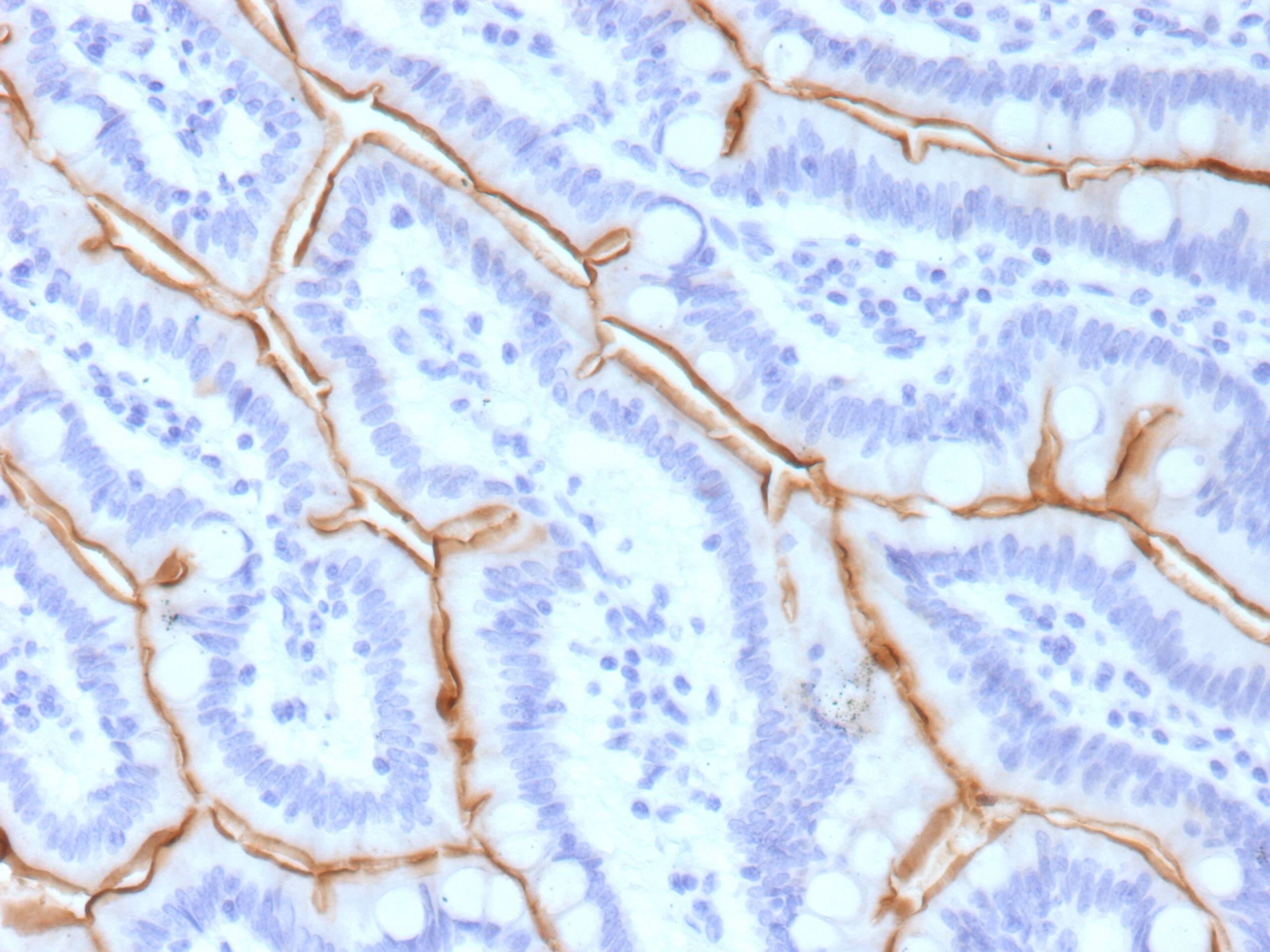 Formalin-fixed, paraffin-embedded human small intestine stained with MUC13 Antibody (MUC13/13111)). HIER: Tris/EDTA, pH9.0, 45min. 2 : HRP-polymer, 30min. DAB, 5min.