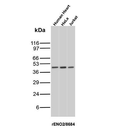 Western Blot Analysis of Human Heart, HeLa and Jurkat lysates using Enolase 2/Neuron-specific Enolase Antibody (rENO/8684).
