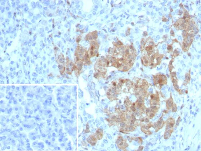 Formalin-fixed, paraffin-embedded human pancreas stained with Enolase 2/Neuron-specific Enolase Antibody (ENO/8253R). Inset: PBS instead of primary antibody; secondary only negative control.