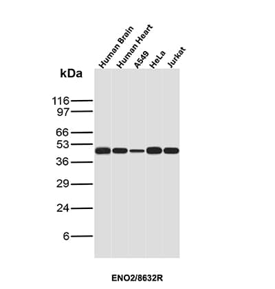 Western Blot Analysis of human brain, human heart, A549, HeLa and Jurkat lysates of different species using Enolase 2/Neuron-specific Enolase Antibody (ENO/8632R).