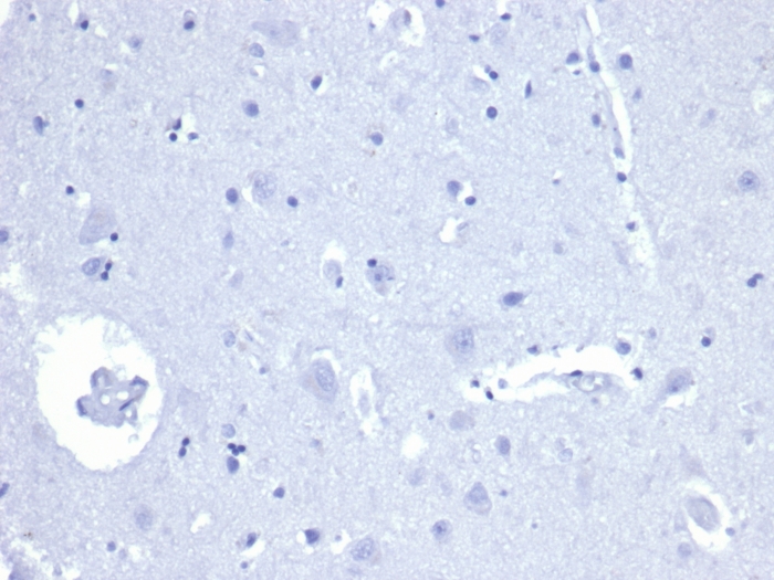 IHC analysis of formalin-fixed, paraffin-embedded human brain. Negative tissue control using alpha-Methylacyl-CoA Racemase/AMACR Antibody (rAMACR/4674) at 2ug/ml in PBS for 30min RT. HIER: Tris/EDTA, pH9.0, 45min. 2�C: HRP-polymer, 30min. DAB, 5min.