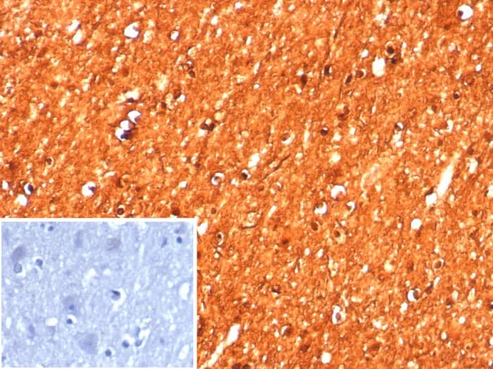 Formalin-fixed, paraffin-embedded human brain stained with Creatine Kinase BB Antibody (CKBB/8608R). Inset: PBS instead of primary antibody; secondary only negative control.