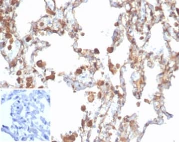 Formalin-fixed, paraffin-embedded human lung stained with Aldehyde Dehydrogenase 1-A1/ALDH1A1 Antibody (rALDH1A1/7285). Inset: PBS instead of primary antibody; secondary only negative control.