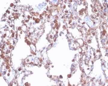Formalin-fixed, paraffin-embedded human lung stained with Aldehyde Dehydrogenase 1-A1/ALDH1A1 Antibody (rALDH1A1/7285). HIER: Tris/EDTA, pH9.0, 45min. 2 °: HRP-polymer, 30min. DAB, 5min.