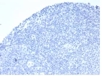 IHC analysis of formalin-fixed, paraffin-embedded human tonsil. Negative tissue control using Alkaline Phosphatase/ALPP/ALPI Antibody (rALP/870)at 2ug/ml in PBS for 30min RT. HIER: Tris/EDTA, pH9.0, 45min. 2 °: HRP-polymer, 30min. DAB, 5min.