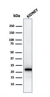 Western Blot Analysis of human Kidney tissue lysate using Ferritin Light Chain Antibody (rFTL/1388).