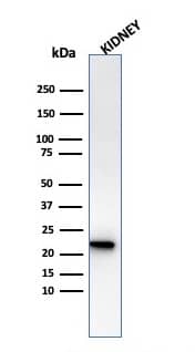 Western Blot Analysis of human Kidney tissue lysate using Ferritin Light Chain Antibody (rFTL/1386).