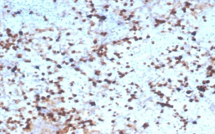 Formalin-fixed, paraffin-embedded human spleen stained with Granzyme B Antibody (rGZMB/4538).