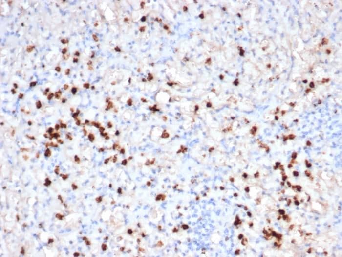 Formalin-fixed, paraffin-embedded human spleen stained with Granzyme B Antibody (GZMB/6530R).